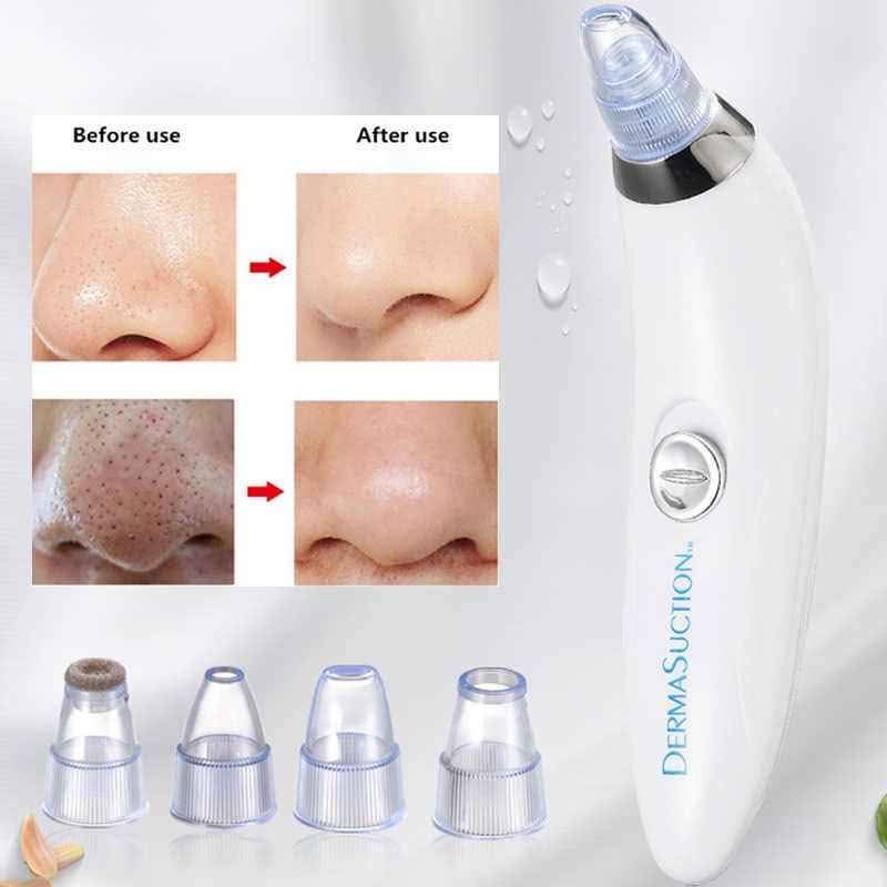 Pore Cleaning Device